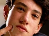 Teen Acne Treatment Teen Acne Treatment
