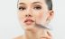 How Will You Pick Good Acne Skin Care Products? How Will You Pick Good Acne Skin Care Products?